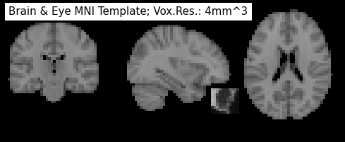 ../_images/2d0f822c5b0105d694fdceae96a90b4de6658fbf3a09c67e6971bce74509783e.png