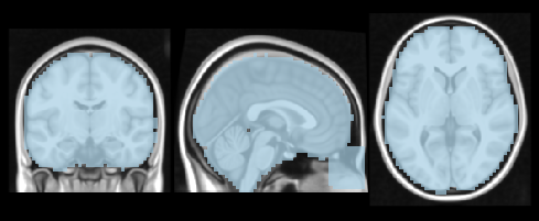 ../_images/53336d92f7cbbc5ea58946750233743332f129a534ecbd572ef79a1dc4cb011b.png