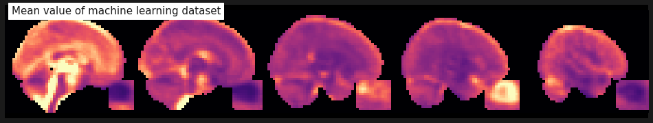 ../_images/b62b453e8170403c70377cd121470513d2b695c784188ebf7d56af0a2e1dbc9d.png