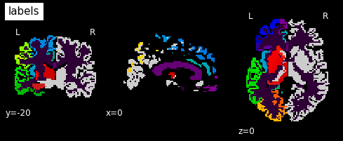 ../_images/c149b81dc8527c5d032dbe27ddc92acac752f8cfb3bbea3cd4f91391557a68b1.png